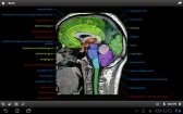 download IMAIOS e-Anatomy apk